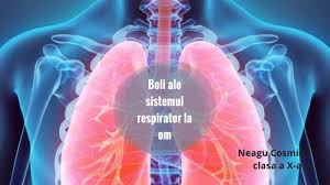 Exista bacterii si virusi care provoaca boli fara sa contribuie factori favorizanti. Boli Ale Sistemului Respirator La Om By Cosmina Neagu On Prezi Next