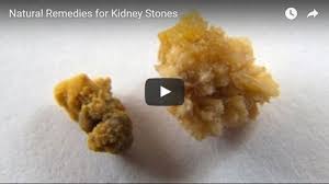 What Are Kidney Stones Kidney Stones Kidney Kidney Stones Remedy