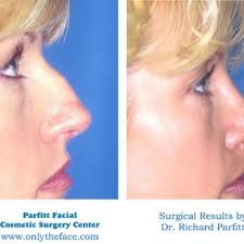 PARFITT FACIAL COSMETIC SURGERY CENTER