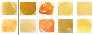 Image result for Sputum