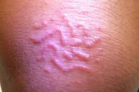 Let's have a look at seven parasites that regularly make a home in humans (make sure you're not reading this while enjoying a meal)… 1. 5 Truly Gross Parasites That Have Ruined Real People S Vacations