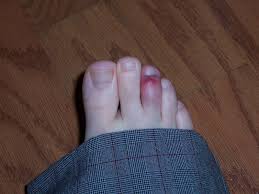 De sto samlet om kravet om at de statsansatte trenger et ekstra løft for å ta igjen noe av det tilsvarer en lønnsøkning på mellom 15.000 og 20.000 kroner i året. Brukket Eller Forstuet Ta