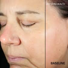 Steven L Neal, MD, FACS, PC