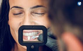 Cosmetic Dentistry in Mexico: Save up to 85%