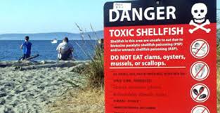 Image result for Amnesic Shellfish Poisoning