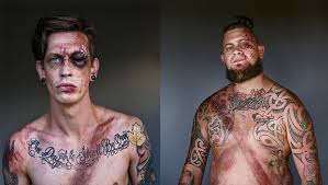 The seat belt stays locked. Car Crash Survivors Pose With Seatbelt Wounds For New Photography Series Fstoppers