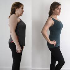 b12 injections for weight loss before