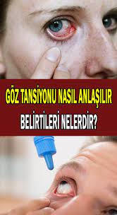 Goz Tansiyonu Ya Da Karasu Hastaligi Belirtileri Nelerdir Nasil Tedavi Edilir 2020 Tansiyon Saglik Formda Kal