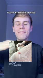 Allan Matheus (@euallanmatheus)