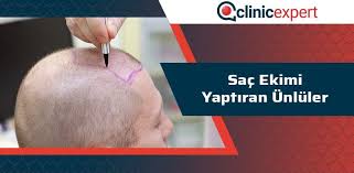 Sac Ekimi Yaptiran Unluler Clinicexpert Uluslararasi Saglik Hizmetleri