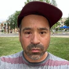 While setting up for Pride, an out City Council candidate is hit with  antigay slurs, a black eye & a police summons