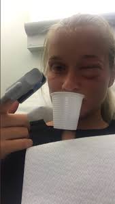 Julia, 19, klappade en katt