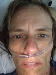 Fundraiser by Cathy Haley Tyner : CATHY'S medical expenses for LYME