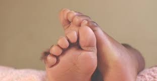 Plantar warts exclusively grow on the soles of the feet and in some cases even palms. What Are Plantar Warts And How Do You Get Rid Of Them Health Com