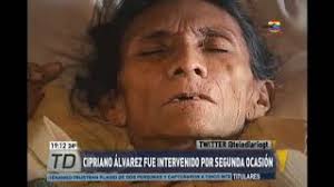 Cipriano Álvarez intervenido por segunda ocasión