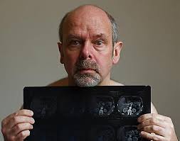 To screen or not to screen