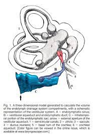 Shunt Treatment For Meniere S Disease