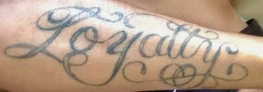 This client did 2 treatments with us (sorry we don't have a photo of the progress before the don't live with tattoos you don't love! Laser Clinic Giving Kids With Tattoos A Second Chance Free Of Charge Cbc News