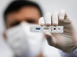 Aprenda a utilizar o teste rápido que comprou na farmácia. Redes De Farmacias Fazem 196 5 Mil Testes De Covid 19 E 15 Dao Positivo Poder360
