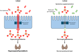 Image result for Hyperphosphatemia