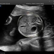 Compra geles para ultrasonidos a precios bajos en amazon.es. Una Tecnologia Con Ia Automatiza El Flujo De Trabajo Del Ultrasonido Obstetrico Ultrasonido Medimaging Es