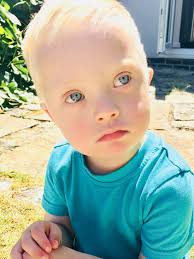 Down's Syndrome Association