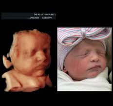 The 4D Ultrasound Lady