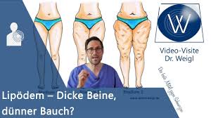 Lipodem Warum Habe Ich Dicke Beine Was Kann Ich Dagegen Tun Ursachen Symptome Therapie Youtube