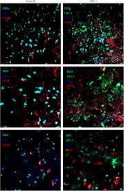 Since any hsv work involves us converting the rgb image, we can dismiss it, so the clear choice is to simply use the green channel of the rgb image for segmentation. Nitric Oxide Influences Hsv 1 Induced Neuroinflammation