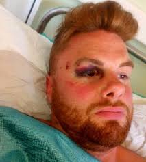 Brit forced to miss wedding after falling 14-foot off Greece balcony