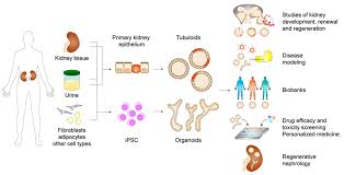 Cells Free Full Text Kidney Organoids And Tubuloids Stones form inside the kidneys and the urine collecting system. kidney organoids and tubuloids