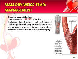 Definitive diagnosis is usually made by esophagogastroduodenoscopy. Gastrointestinal Bleeding Ppt Video Online Download