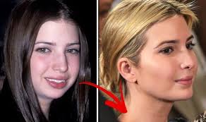 Let S Remember When Ivanka Trump Revealed She S Totally Addicted To Chapstick Chin Implant Celebrity Plastic Surgery Plastic Surgery