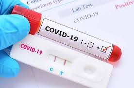 Bukan Lagi 7 Dan 3 Hari Masa Berlaku Pcr Dan Rapid Test Kini Sampai 14 Hari Semua Halaman Grid Health