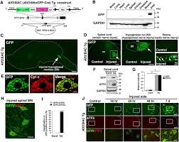 The result will be in the units that you enter into the fields. Mitochondrial Fission Is An Acute And Adaptive Response In Injured Motor Neurons Scientific Reports