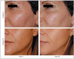 Пьете ли коллаген?