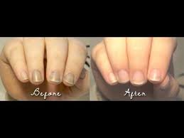 how to remove hair dye from nails