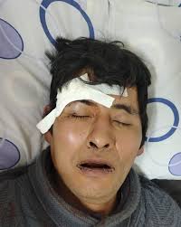 🚨URGENTE🚨 Se busca a los familiares del paciente IMAR ARACENA GUERRERO  quién fue encontrado en vía pública por personal de Bomberos, familiares  deben acudir a la brevedad posible por EMERGENCIAS del Hospital