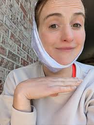 I got a crown this last Wed and I knew it would be tough with a robotic jaw  (I had TJR of my TMJ in August due to idiopathic condyle resorption) so