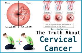 All these symptoms can be caused by conditions other than cancer, but it's important to go to the gp and get any unusual. Cervical Cancers