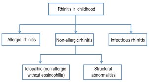 Image result for Rhinitis