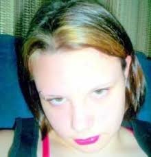 Poliosis (also called poliosis circumscripta), is the decrease or absence  of melanin (or colour) in head hair, eyebrows, eyelashes or any other hairy  area. Shout out to myself for apparently being super