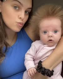 Meet ten-week-old baby Arla whose mum, Aliyah Lewis, has been documenting  her daughter's 'crazy' hair. Arla was born with her hair sticking upright  which prompts members of the public stopping her in