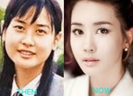 Korean Actors And Actresses Before And After Plastic Surgery Korean Actorsactresses Before And After Plastic Surgery K Drama Korean Actors And Actresses Before