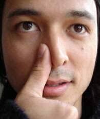 How To Stop A Nose Bleed Fast Nose Bleeds Nose Problems Stop Nose Bleeds