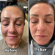 Profile for Nurse Nel Aesthetics