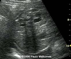 Dedicated To The Mission Of Bringing Free Or Low Cost Educational Materials And Information To The Global Ultrasound Community