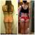 Cellulite Before And After Weight Lifting