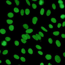 Image result for ANA Staining Pattern