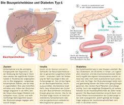 Diabetes Mellitus Typ 1 Bei Kindern Und Jugendlichen Gesundheitsberater Berlin